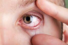  Negative impact of using mobile phones on eyes